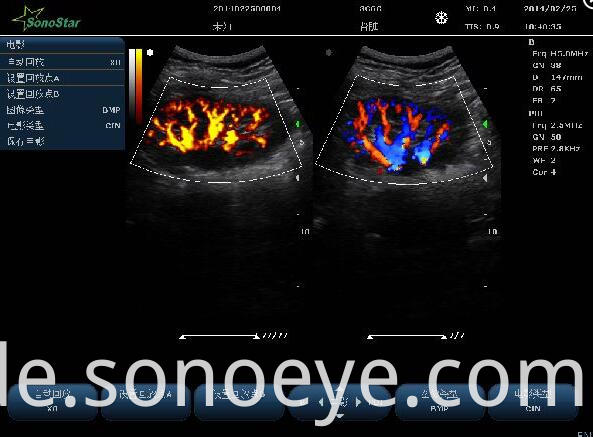 C10Pet Ultrasound Color Doppler